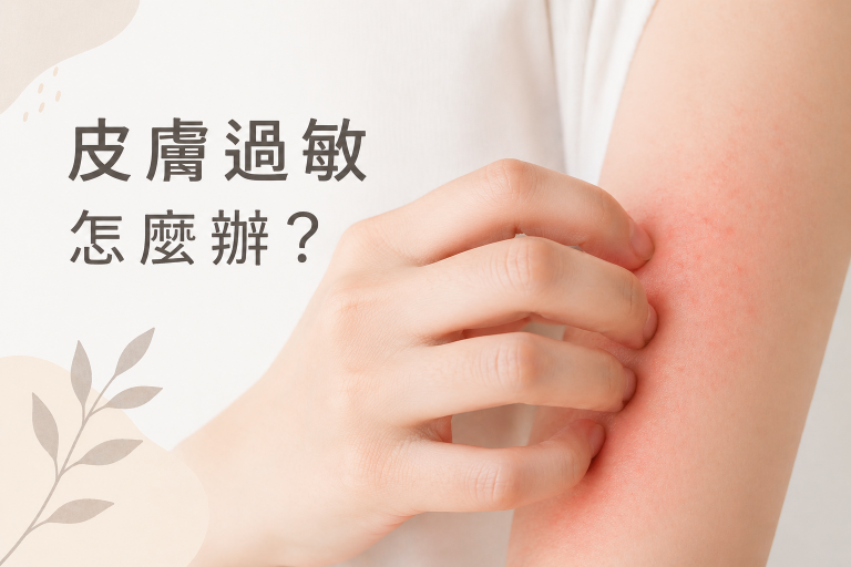 保養品皮膚過敏怎麼辦？與敏感肌差異？5 大過敏原、3 步驟事前避免